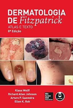 Dermatologia de Fitzpatrick: Atlas e Texto