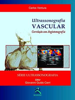 Ultrassonografia Vascular: Correlação com Angiotomografia